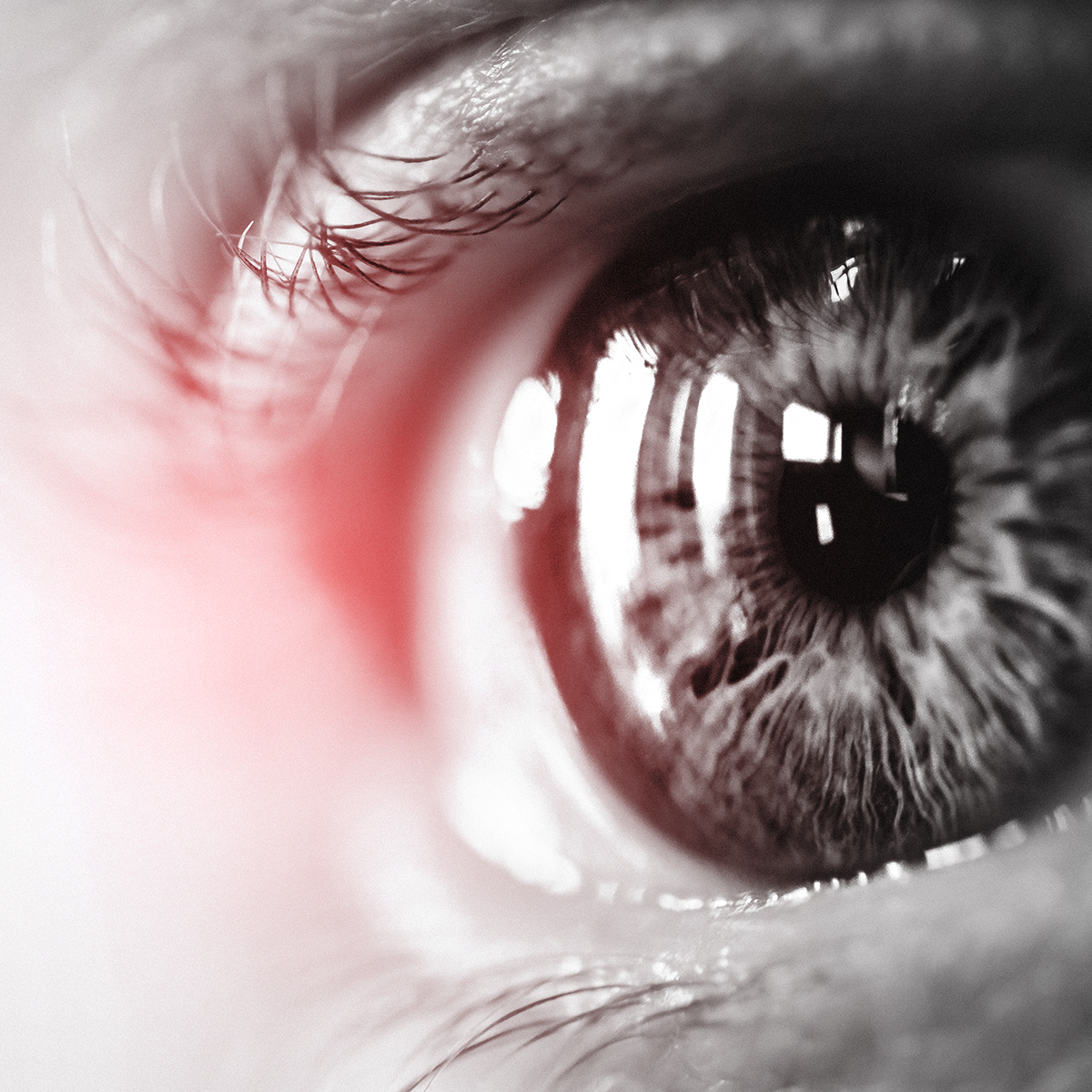 Lentes de contacto para miopia y astigmatismo